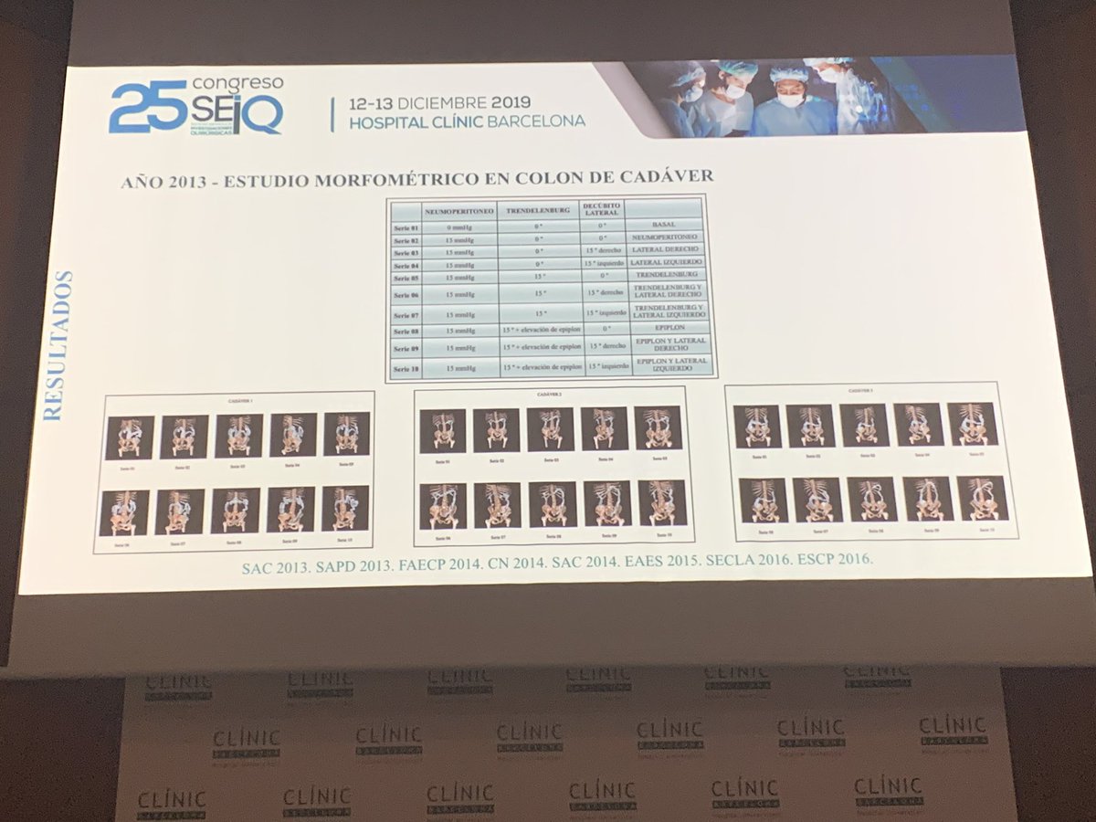 juliomayol's tweet photo. Comunicaciones libres - empieza @jftrebolle @JLBlasLaina #SEIQ19 #SoMe4Surgery @SEIQuirurgica @belenporrero https://t.co/6vIaR4nFlz