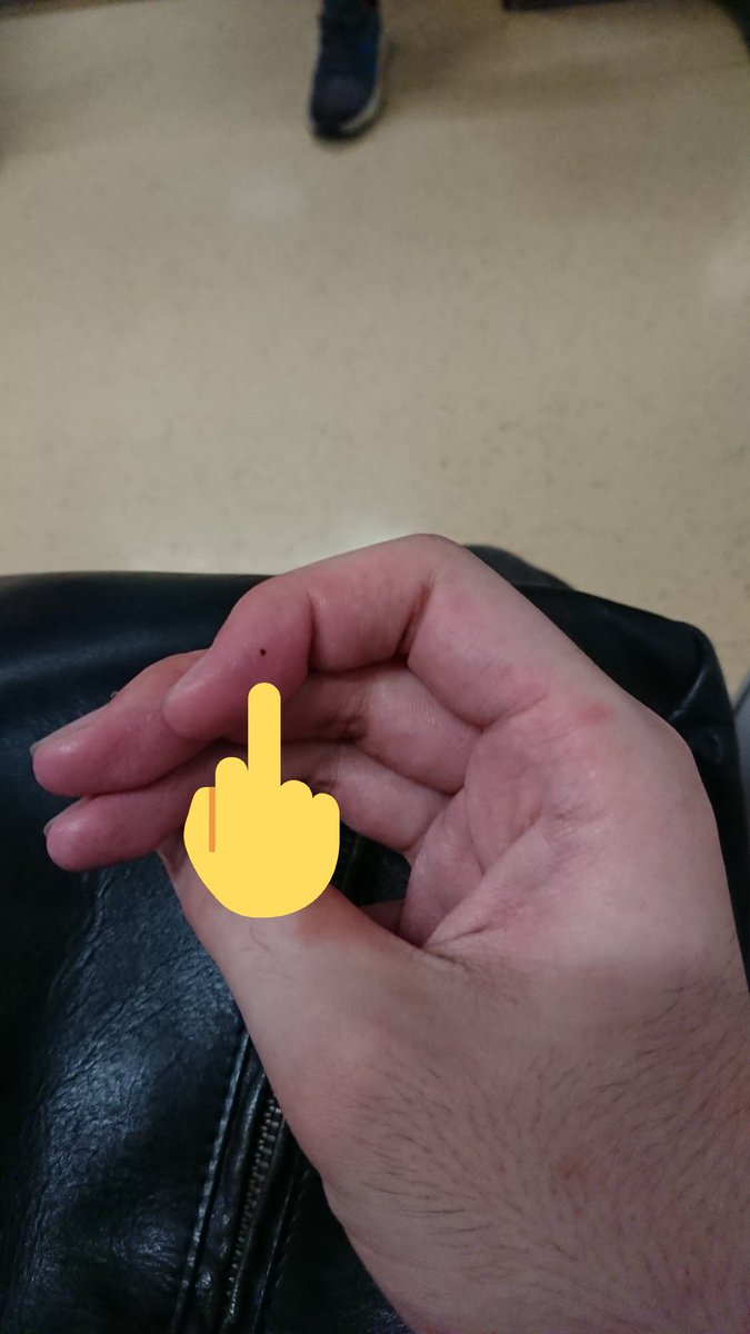 てかくそでもいいんだけど今月右手の人差し指にほくろが増えた