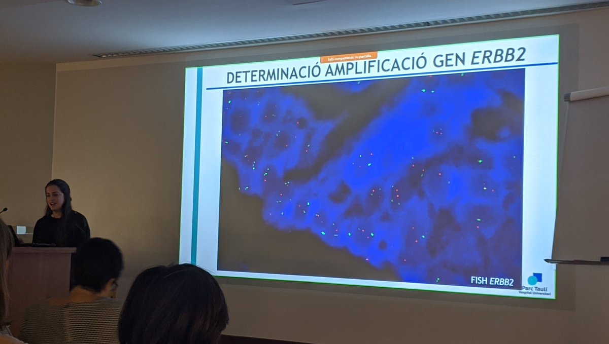 SCAPSoMe's tweet image. La Dra Berta Bella de l&apos;H Parc Taulí ens demostra que no és tan fàcil interpretar HER2 #scap2020