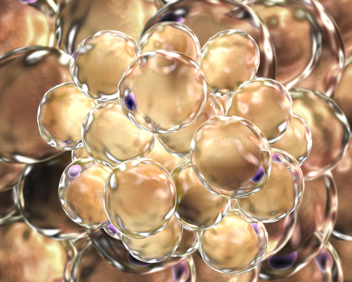 BioRestorative's tweet photo. BioRestorative Therapies Receives Patent in Israel For Its Metabolic Program
https://t.co/jiRBKjfNdD
#patents #intellectualproperty #israel #brownfat #adipose #metabolic #thermostem #biorestorative $BRTX #microcap #stemcell #regenerativemedicine #cellbiology #science #biotech https://t.co/b7hTM8vGCO