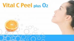Vital C Peel plus O2 Vitamin C, bitkisel kök hücre, glikolik asit, alfa hidroksi asitler ve oksijen ile güçlendirilmiş yoğun leke açıcıdır. İçeriğindeki etken maddeler sayesinde Vital C maksimum beyazlık etkisi ve renk açıcı etki sağlamaktadır.