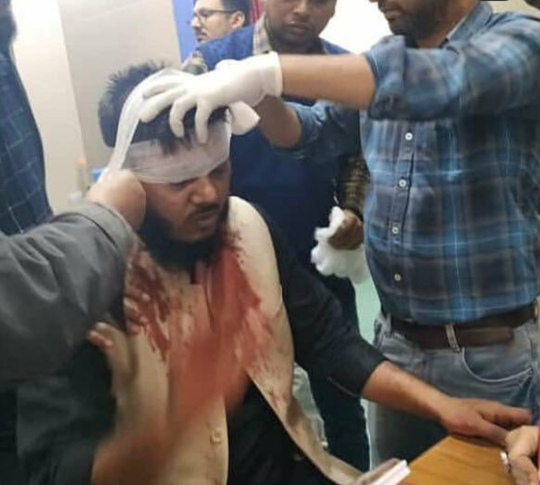 iAzharHasan's tweet photo. Police attacked #Jamia students peacefully protesting against CAB
#IndiaRejectsCAB #IndiaAgainstCAB #CAB_Protest https://t.co/nAFGa4nI1R