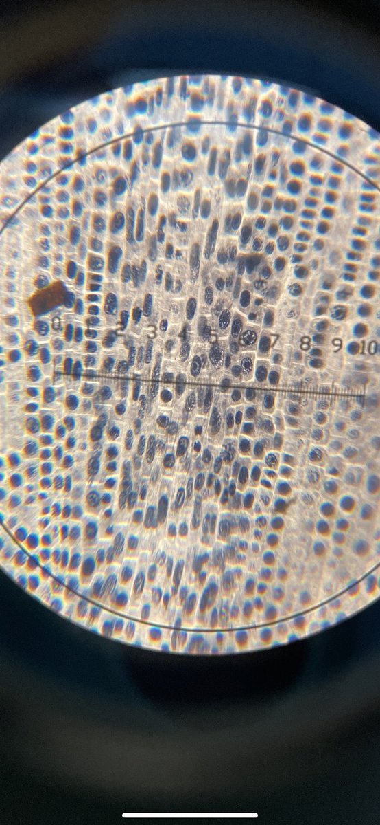 QEHSScience's tweet photo. Year 12s have been busy viewing cells during mitosis using a microscope this morning. Can you identify any stages? #mitosis #prophase #metaphase #anaphase #telophase #cellbiology https://t.co/JgFHEGmD7p