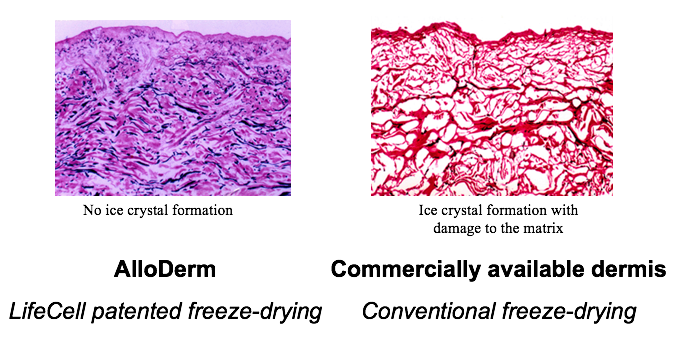 BioHorizons's tweet photo. #AlloDerm’s patented cryopreservation process retains its biochemical and structural components (ECM) and maintains the tissue’s natural regenerative properties. | https://t.co/cj4XKO0m1o #DentalImplants #HealthySmiles #Biologics https://t.co/2GuEgkWIgp