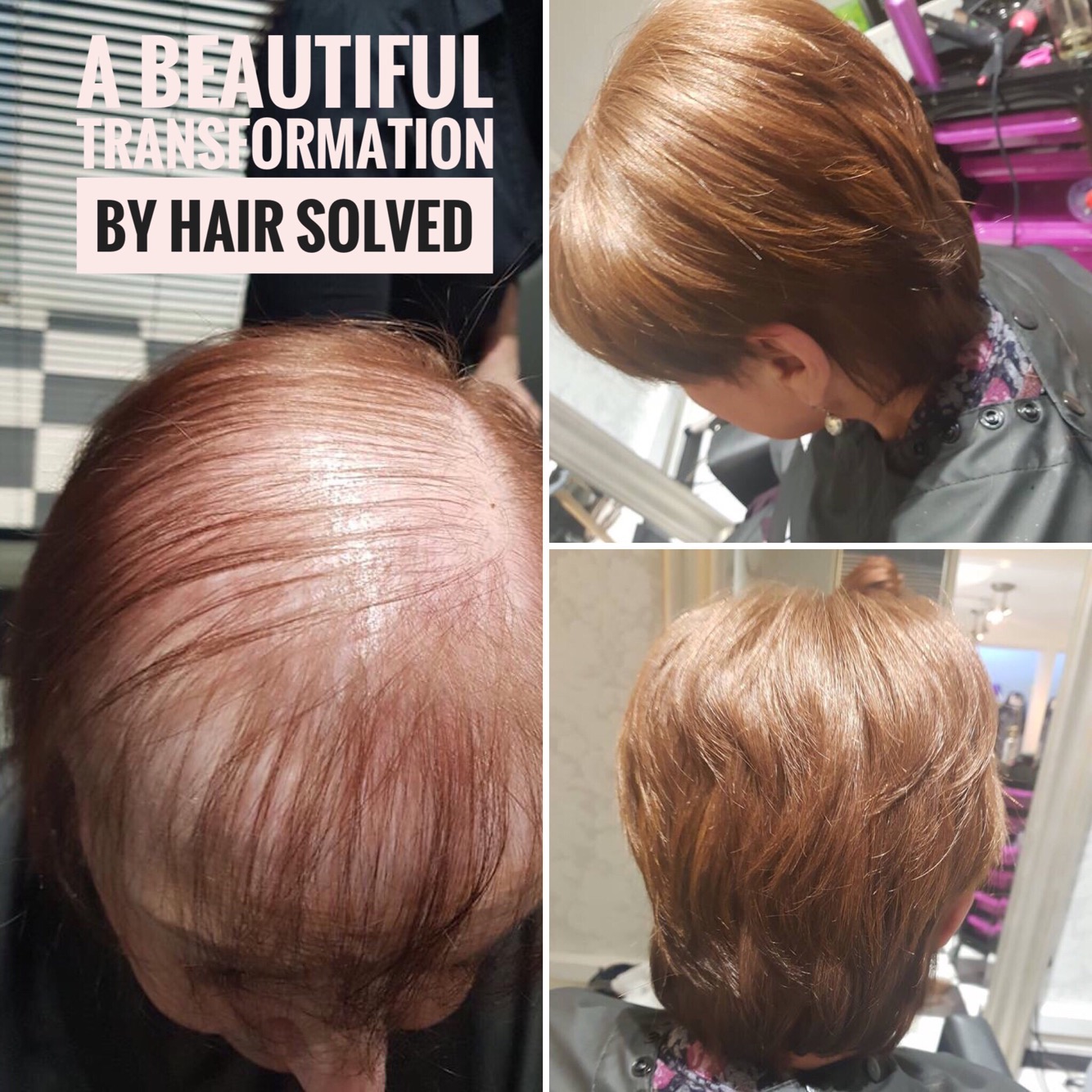 Hair Solved on Twitter: Hair Solved on Twitter: