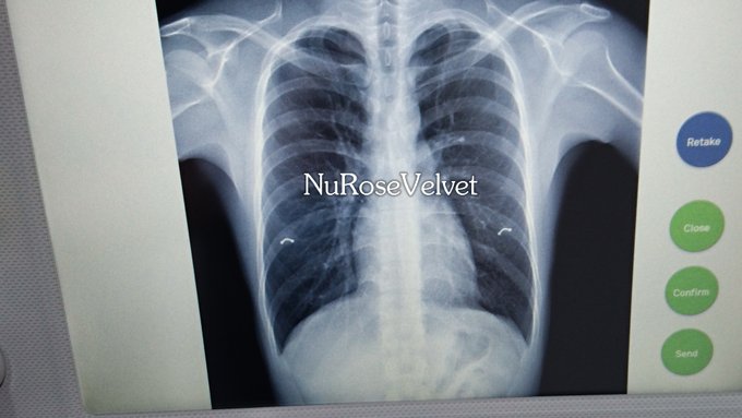 ไม่ค่อยสบายอ่ะ :P  #nipple #piercing #เจาะหัวนม https://t.co/EqijVQ4ken<a href="/tag/nipple"class="tags">#nipple</a><a href="/tag/piercing"class="tags">#piercing</a><a href="/tag/%E0%B9%80%E0%B8%88%E0%B8%B2%E0%B8%B0%E0%B8%AB%E0%B8%B1%E0%B8%A7%E0%B8%99%E0%B8%A1"class="tags">#เจาะหัวนม</a>