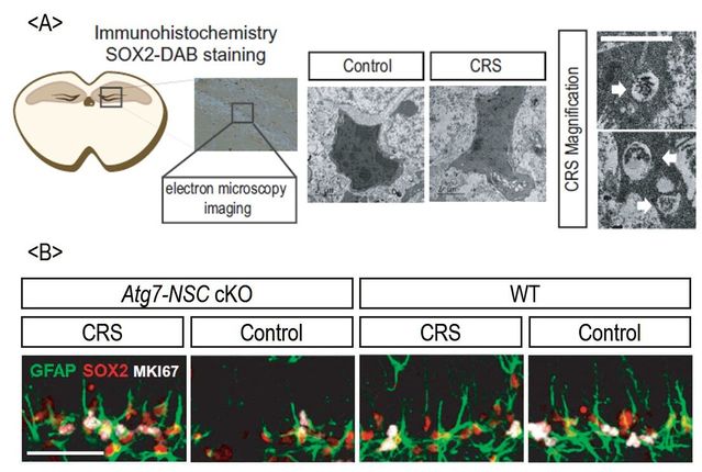BrainFitNow's tweet image. Chronic Stress May Trigger a Double Whammy of Brain Damage | Psychology Today ow.ly/zd8250xdbto #Alzheimers #dementia #dementiarisk #brainhealth