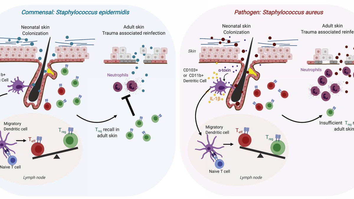 cellhostmicrobe's tweet photo. Baby’s First Bacteria: Discriminating Colonizing Commensals from #Pathogens. @YUEXING_1 @DrShrutiNaik highlight recent work from @ScharschmidtLab @john_leech07 examining how the neonatal #immune system selectively generates tolerance to #commensals https://t.co/gKPTelpEcq https://t.co/pQ9IBPF2PH