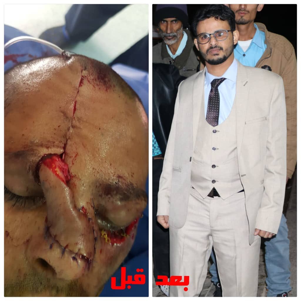 الملف كبير والصور كثيرة - قبل وبعد -عن الحالات التي تم علاجها على منحة صاحب السمو الشيخ محمد بن زايد آل نهيان ، وهذه الصور من مكتب شؤون الجرحى بجمهورية مصر .
#شكرا_محمد_بن_زايد