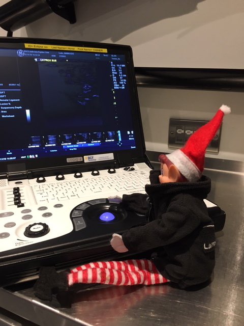 These scans just look like snow to me!