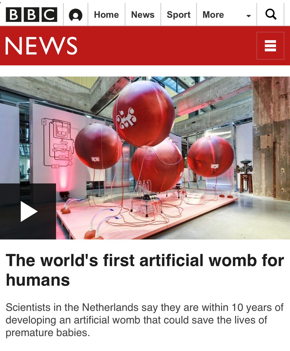 BeccCobain's tweet photo. In 10 years or so a baby born at 22 or 23 weeks might be immediately placed into an #artificialwomb to continue growing before being born again. Two different countries are working on this. Pretty amazing. 💕 https://t.co/7TZndU7D6W