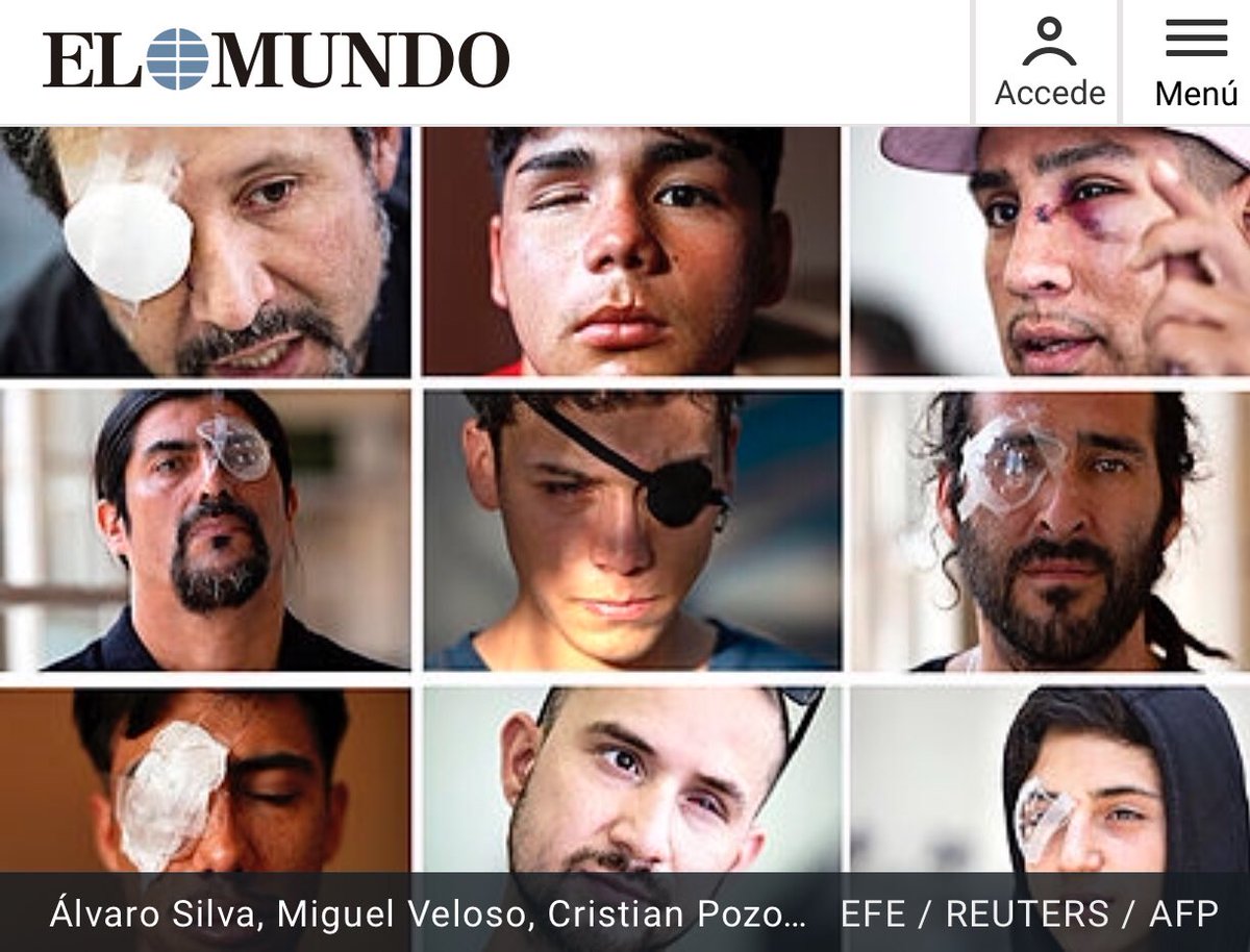 kunamaskta's tweet photo. @ceciliamorel Le parece bien sacarles los ojos a las personas o dejarlas ciegas? Porque eso hace SU ESPOSO @sebastianpinera responsable de las políticas criminales de este Gobierno  #ChileViolatesHumansRights  #Odiosa #Hipocrata #Alienigena https://t.co/Z6KaeOMNYO
