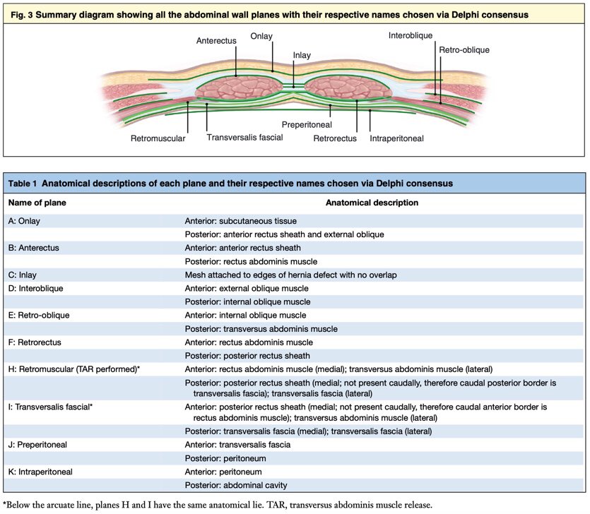 A landmark paper for #herniasurgery!

International consensus on nomenclature for abdominal wall planes 

<a href="/BJSurgery/">BJS</a> bjssjournals.onlinelibrary.wiley.com/doi/abs/10.100… #hernia #SoMe4Surgery