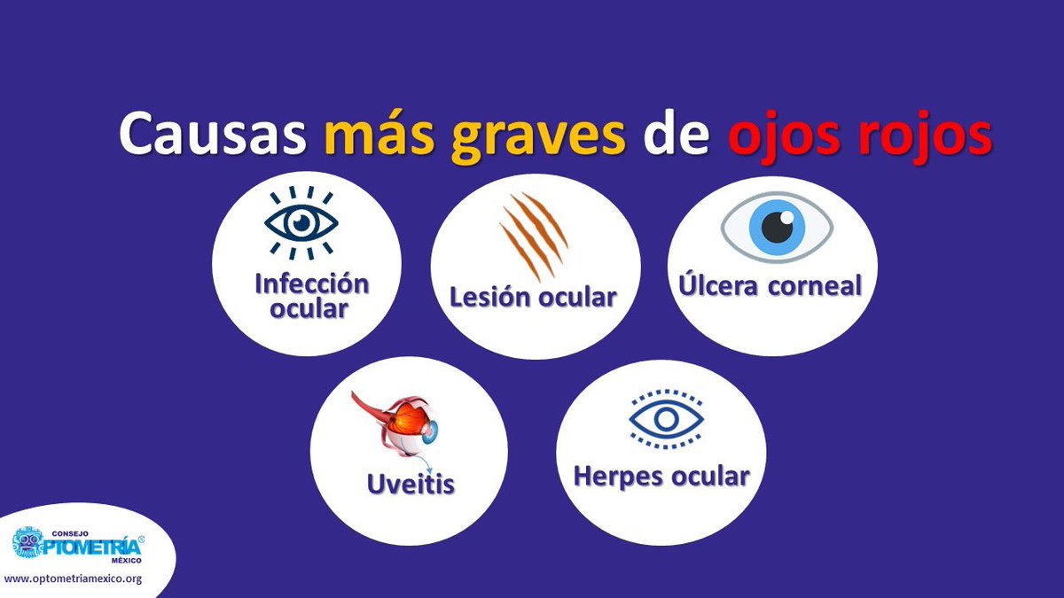 OptometriaMexic's tweet photo. 14. Las causas más graves de ojos rojos deben ser atendidas de inmediato para no poner en riesgo la visión. ¡Mantente alerta!
#Optotips #Optometría #Ojosrojos https://t.co/pqEwmCGOHr