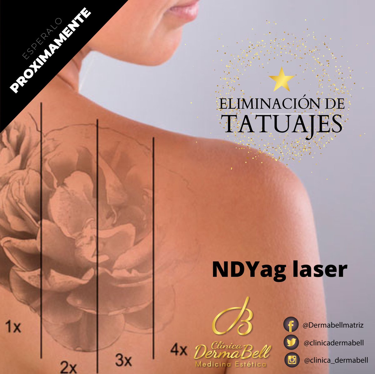 dermabellmx's tweet photo. ¿Listos para la eliminación de esos tatuajes?

Muy pronto podras hacerlo de manera segura y eficaz con nuestro nuevo tratamiento láser ND- Yag de Clínicas #DermaBell. ✨

¡Reserva desde ahora, en cualquiera de nuestras cuatro clínicas! https://t.co/ixZEhANc3M