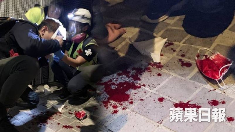 HVersammlung's tweet photo. #Pressefreiheit?! im Nahbereich oder auf Kopf mit Tränengas, Gummigeschoss und Pfefferspray gefeuert und attackiert, #Presseausweis vor Linse der Live-Übertragung von Polizei gezeigt. Polizist schrie: Glaubst du gibt es wirklich die #vierteMacht der Presse? https://t.co/iyI71Xbo28