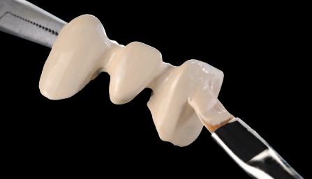 FullService_CDL's tweet photo. #dentist #dentistry #dental #crowns #Porcelain 
outsourcing service help you cost-saving, contact me:email:mr.doczhang@gmail.com.
whatsapp and wechat:+86 18823711832 https://t.co/MpFXbQFfWi