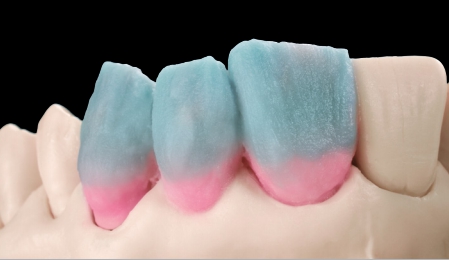 FullService_CDL's tweet photo. #dentist #dentistry #dental #crowns #Porcelain 
outsourcing service help you cost-saving, contact me:email:mr.doczhang@gmail.com.
whatsapp and wechat:+86 18823711832 https://t.co/MpFXbQFfWi