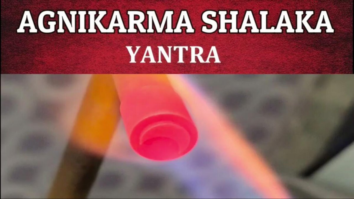 sandhya_engg's tweet image. Agnikarma shalaka
Type of Agnikarma shalaka
✅✅✅
facebook.com/sandhyaenggwor…