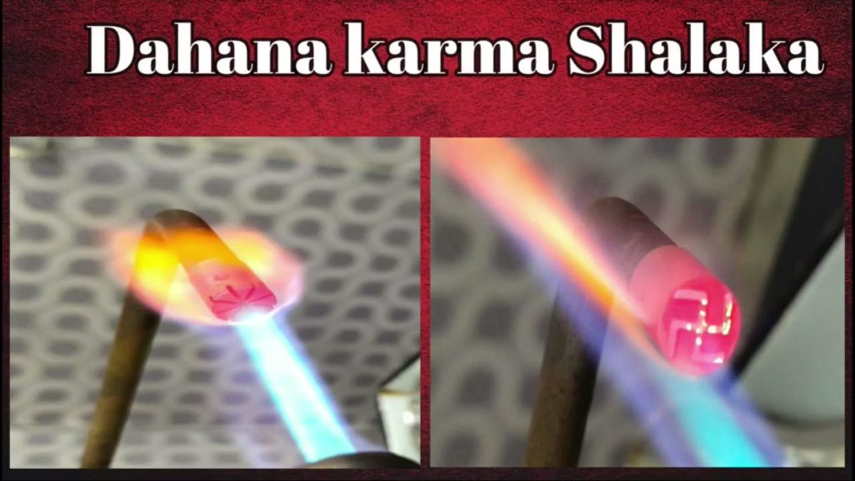 sandhya_engg's tweet image. Agnikarma shalaka
Type of Agnikarma shalaka
✅✅✅
facebook.com/sandhyaenggwor…