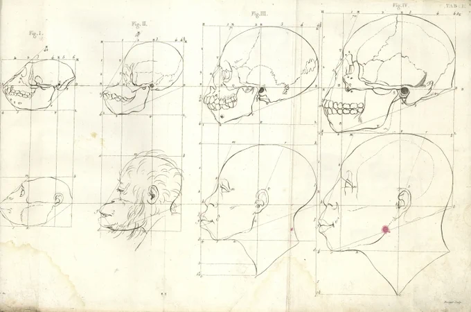 カンパーの「顔面角」(1791)。19世紀まで美術解剖学の教科書に度々引用されたが、黒人種をサル(オランウータン)に近く、白人種を古代ギリシャの神(アポロン)に近づけて並べたため、現代ではあまり使用されない。 