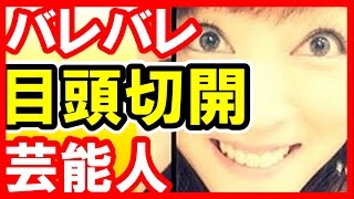 巣ごもりアフィリエイト生活 整形失敗で吉澤ひとみヤバス 目がぁ 目頭切開バレバレな女性芸能人top5 辻希美 吉澤ひとみ きゃりー 益若つばさ他 芸能おもクロ秘話ニュース T Co Ljlhjayxoq
