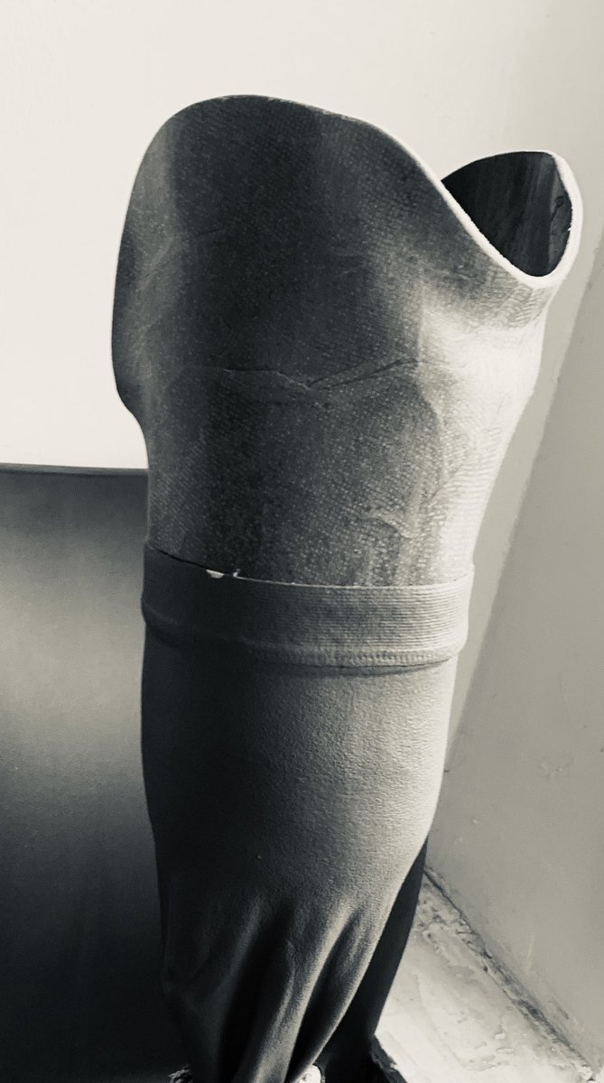 John Ngigi,OGW (@ngigi_dr) on Twitter photo Assessment of volume status is crucial in dialysis and is often inaccurate especially in Pts new with a prosthesis.Bioimpedance or IVC diameter assessments can be better than clinical for more accuracy <a href="/ButterflyNetInc/">Butterfly Network</a> <a href="/joeruturi/">Dr Albert J Ruturi</a> <a href="/MoturiMorara/">Moturi Morara</a> Assessment of volume status is crucial in dialysis and is often inaccurate especially in Pts new with a prosthesis.Bioimpedance or IVC diameter assessments can be better than clinical for more accuracy <a href="/ButterflyNetInc/">Butterfly Network</a> <a href="/joeruturi/">Dr Albert J Ruturi</a> <a href="/MoturiMorara/">Moturi Morara</a>