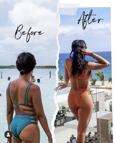 SlimStudioAtl's tweet photo. Jasmine came to see us at Slim Studio for treatment of her "bra roll" area. You know that annoying bulge right beneath the bra line? 90 days later, her back is smooth &amp; "bulge-free!" She looks amazing from head to toe and is feeling more confident at the pool! ❄️💙❄️ https://t.co/kP63lcYLqE