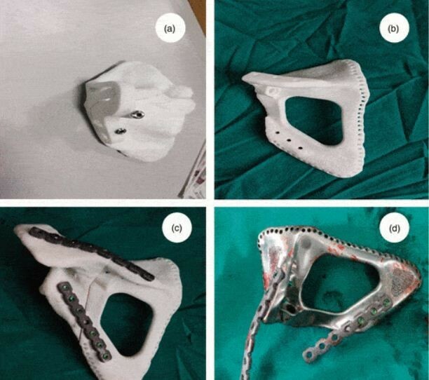 3dheals's tweet photo. From Academia: 3d printed pills, 4D printed structure, and how to property 3D print chocolate @3dheals @US_FDA #3dprinting #pills #4dprinted #structure #issuereconstruction #FDM #Microcatheterization #technology #bioprinting #3dvisualization #JointheTrib… https://t.co/Ygmrx5PsnE https://t.co/KXoUN8NNkt