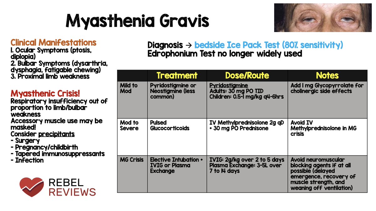 REBEL Review 93: Myasthenia Gravis via J. Yosuf Alam

rebelem.com/rebel-reviews/

#FOAMed #myastheniagravis