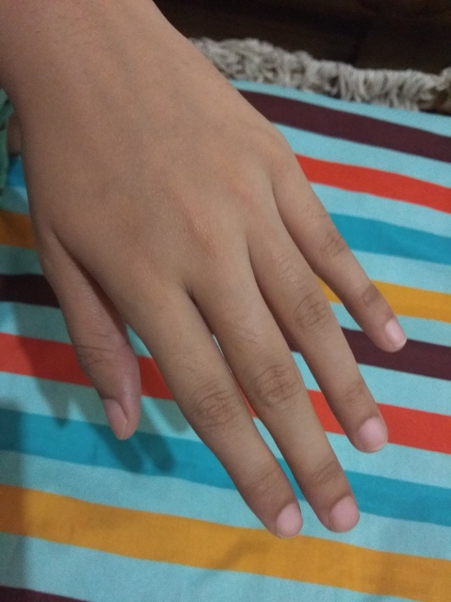 nurdiantifi's tweet photo. MENCERAHKAN BADAN HANYA DENGAN SATU PRODUK

Awalnya belang karena sinar matahari, jadi putih cerah kembali ke warna kulit asal dan merata ke seluruh tubuh terus lebih lembut ditambah wangi banget

minta retweetnya dulu~

from this:                    to this: https://t.co/TReonBxVtk
