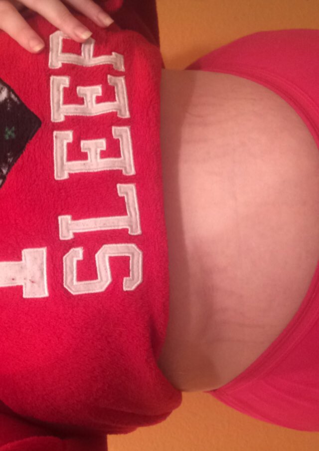 svftpeachies's tweet photo. A post of things I’m insecure about but want to love one day:
My back fat
The way my breasts sag(I’m starting to love those more and more everyday)
And my stretch marks on my stomach. https://t.co/R7RrbZYqmj