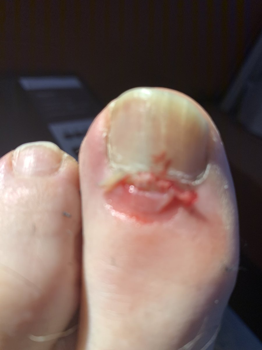 rorybremner's tweet photo. Does it hurt when a big horse treads on your toe? Yes it does. It really does. @LiverpoolInt #liverpoolint https://t.co/QnuNGUCtwm
