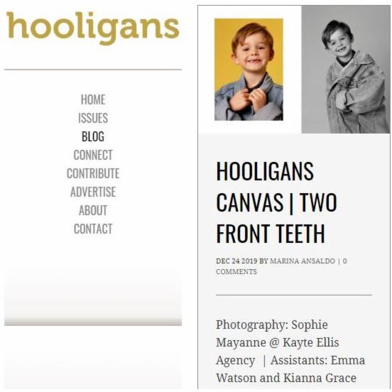 kiannagrace1's tweet image. Had an amazing time assisting @sophiemayanne on this great photo shoot just before Christmas !! 😀🦷📸 #kids #missingteeth #frontteeth #assisting #helping #assistant #styling #clothing #fun #kidsshoot #photoshoot #smiles #toothlesssmiles  hooligansmagazine.com/hooligans-canv…