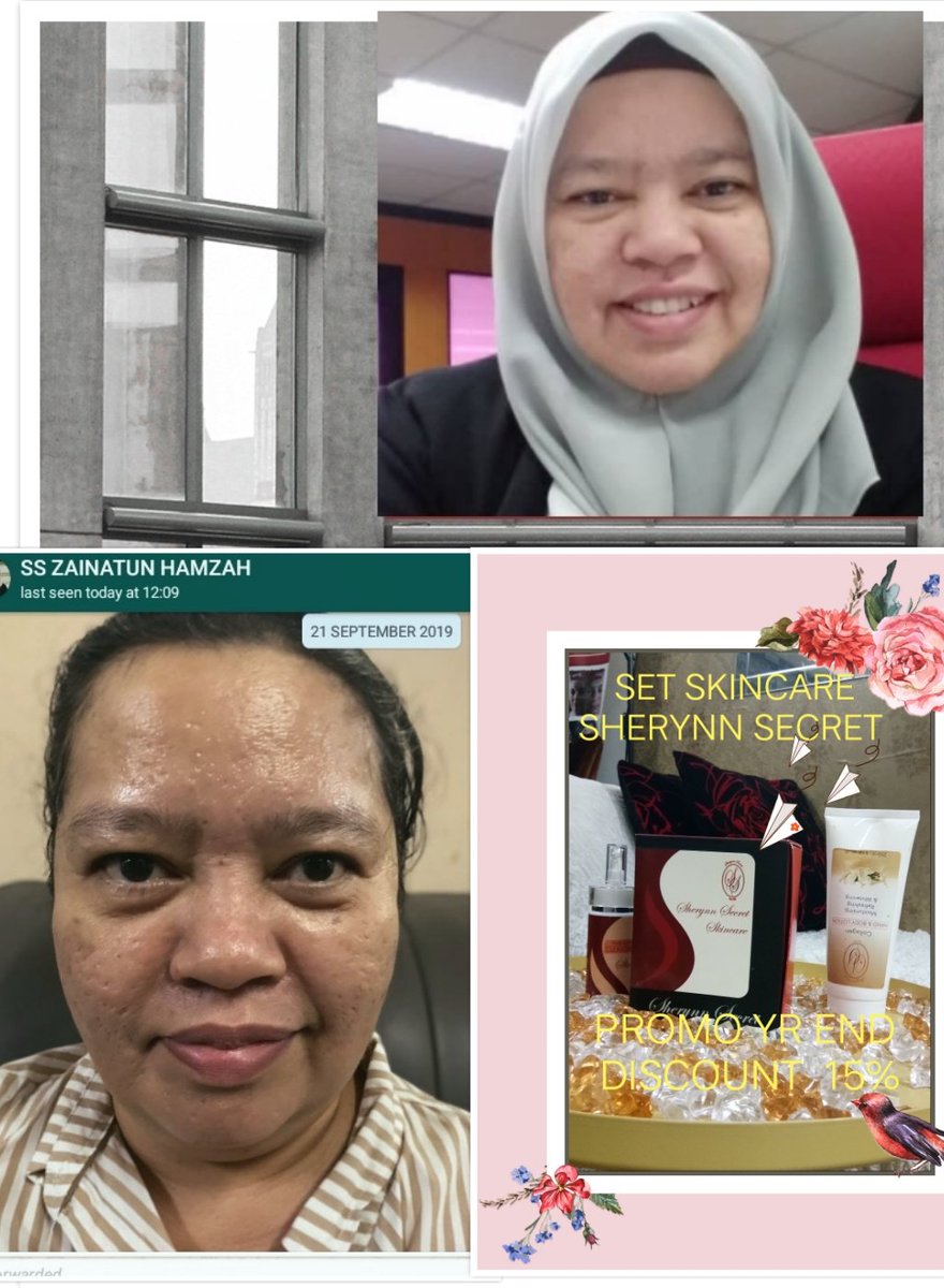 Sherynn Secret Beauty World Sherynasherynn Twitter