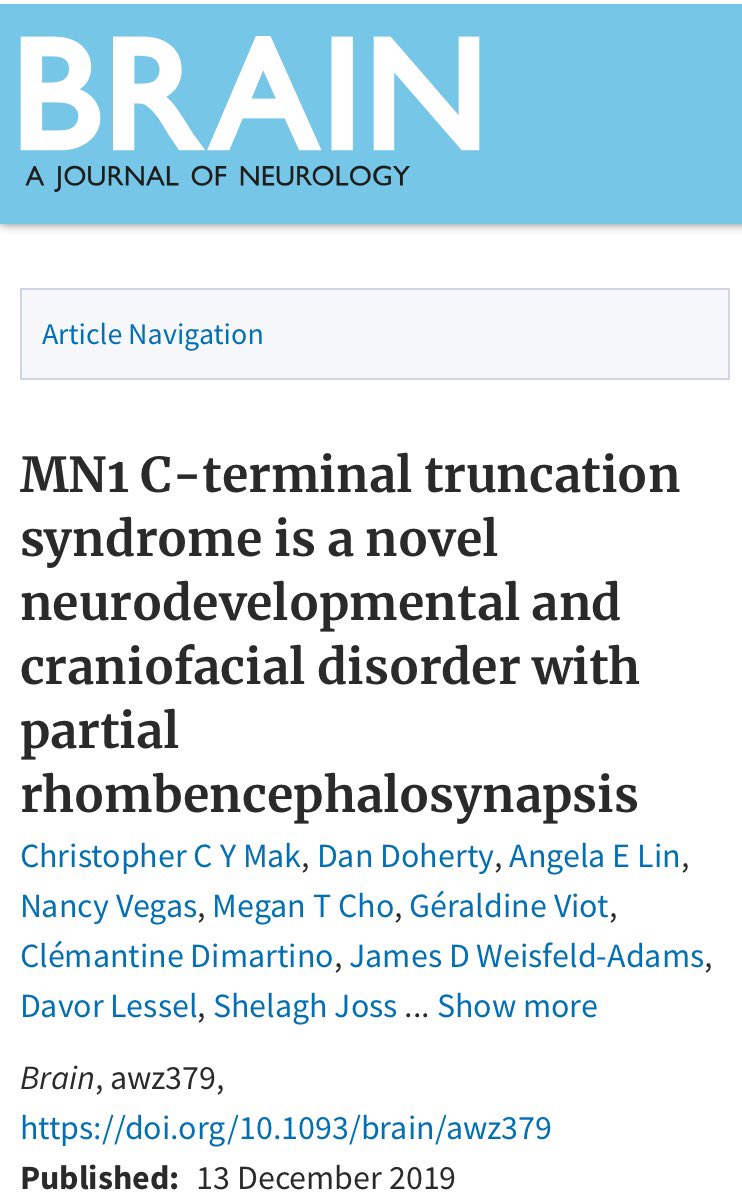 cgonzagaj's tweet image. Ahead of print in @Brain1878 our article describing MCTT, a new #RareDisease neurodevelopmental syndrome with brain anomalies &amp;amp; recognizable dysmorphic features caused by C-terminal truncations in #MN1 leading to dominant negative C-term truncated proteins academic.oup.com/brain/advance-…