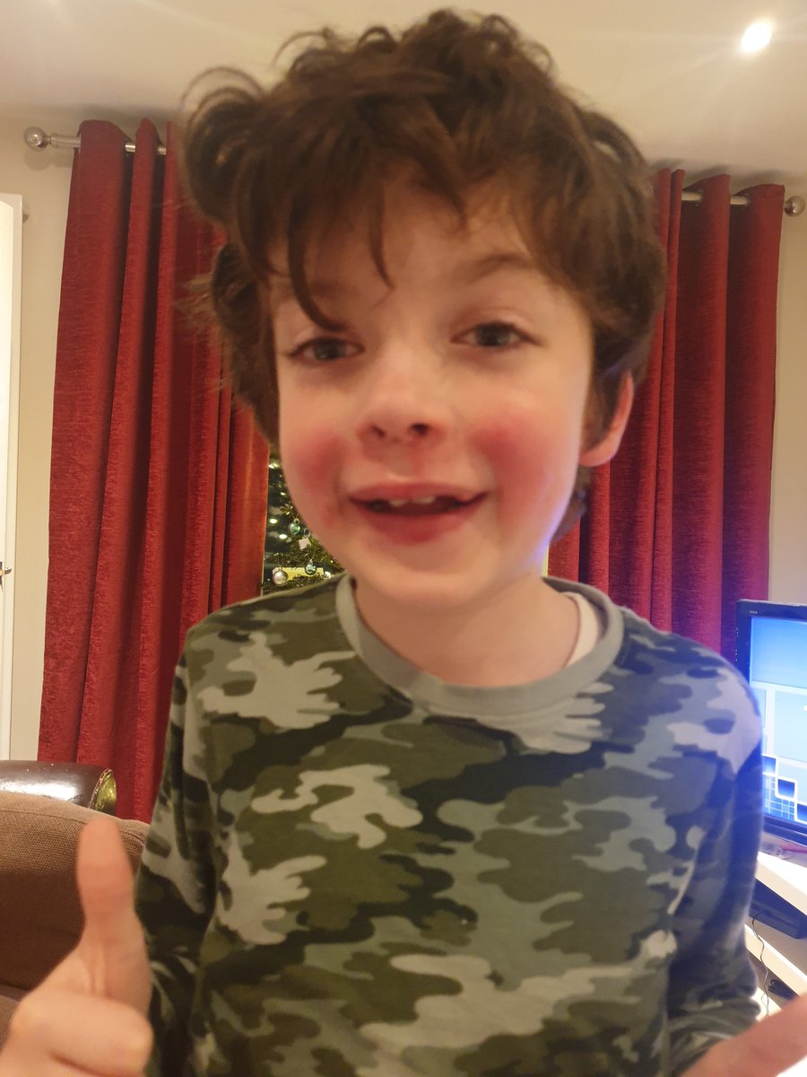 When your best buddy is sick but doesn't want to make u sad worrying about him... 
#kidsaregrate