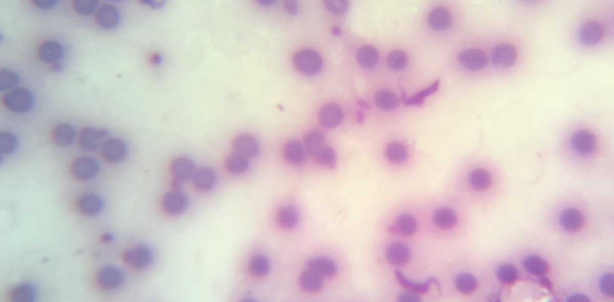 SaludISCIII's tweet photo. Un estudio del Centro Nacional de Medicina Tropical #ISCIII recomienda una mayor implicación de los profesionales sanitarios de atención primaria en el manejo de la enfermedad de #Chagas. Se publica en @PLOSNTDs.
 
📰 Lo puedes leer en #NoticiasISCIII  👉 https://t.co/TnSWmxdxJP https://t.co/KDY6MyW8z7