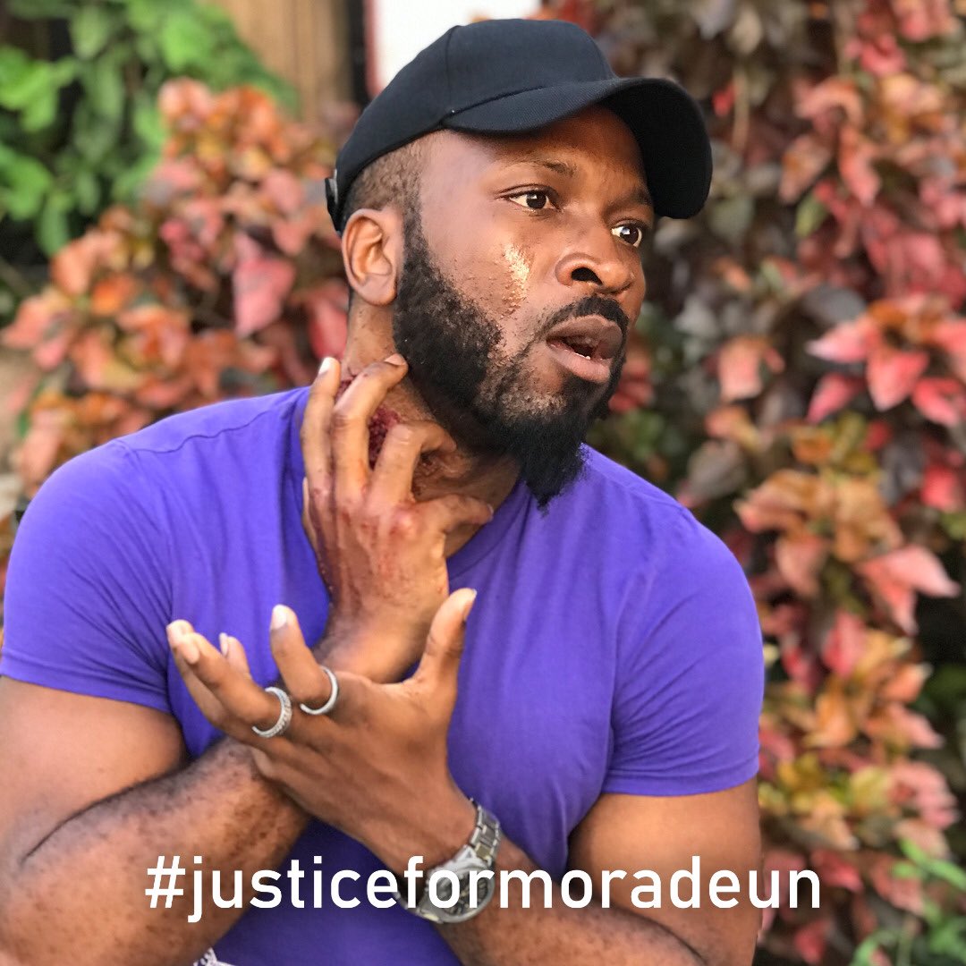 FisayoCheck's tweet photo. Who and where are those that stabbed Moradeun?
Where are the accomplices?
We want action!!!
#efitbeyou
#justiceformoradeun
#formoradeunfornation https://t.co/yV503H02VS
