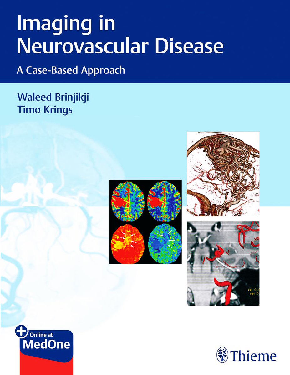 YoungNIR's tweet image. 🎁HOLIDAY BOOK GIVEAWAY🎁 

One lucky winner will receive a copy of @WBrinjikji ‘s book. @ThiemeNY has a special discount code(25% off) if you can’t wait : WNTR25 bit.ly/2PVzNmi  

Here’s how you can win:
-FOLLOW @YoungNIR 
-Retweet &amp;amp; Like 
-Winner announced in 1 week!