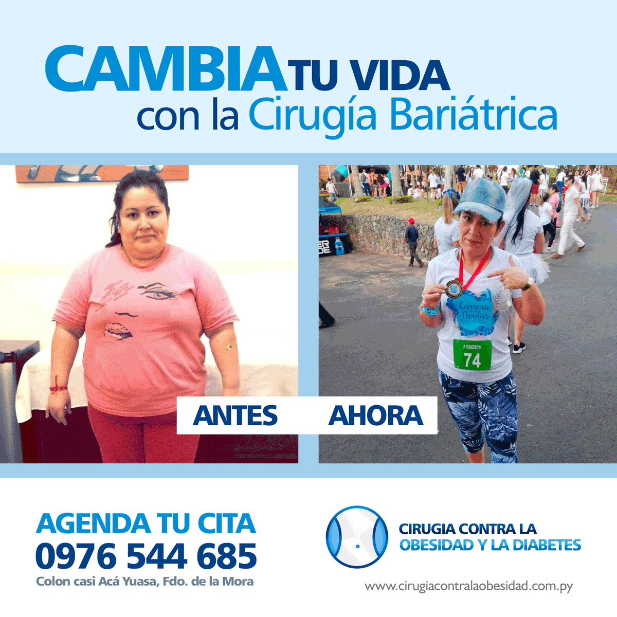 Bariatricapy's tweet photo. CAMBIA TU VIDA CON LA CIRUGÍA BARIÁTRICA. Estamos en: 📍https://t.co/lCdVWc5n2b - 📲AGENDA TU CITA (0976) 544 685 #CirugiaBariatrica #VivirSinObesidad #VivirSano #VvirSinDiabetes https://t.co/VbcxxiRiVl