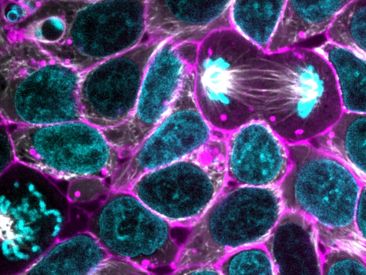 JonathanFanClb's tweet photo. Get Your Body to Work for You — Not Against You — By Supporting 3 Top Pathways That Clean Out Cellular Waste Products and Foreign Invaders - https://t.co/Px9XT8dOE6

#AutoimmuneSecrets
#WomensHealthSecrets
#NaturalHealthSecrets https://t.co/N4vqW5T0om