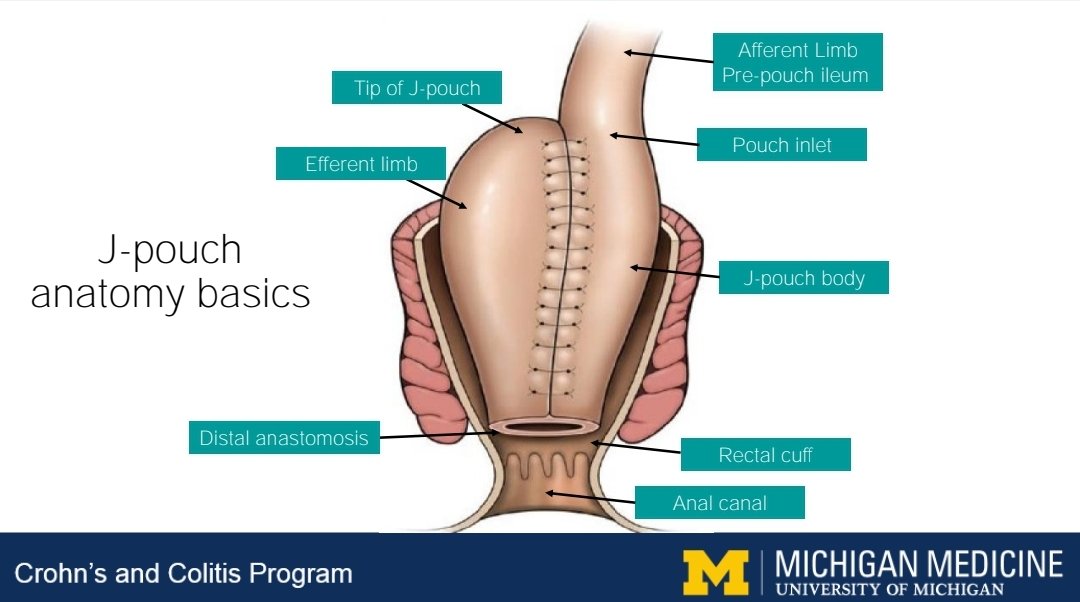 J Pouch Anatomy