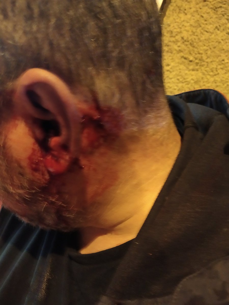ElGorbs's tweet photo. Difusió!!! FOAM a 2 metres. Estava just al costat. Travessera Corts alçada 136. Li han reventat la orella. @mossos apuntant al cap, a dos metres. NO FEIEM RES. 

@jordiborras https://t.co/84kwjiKV6Q
