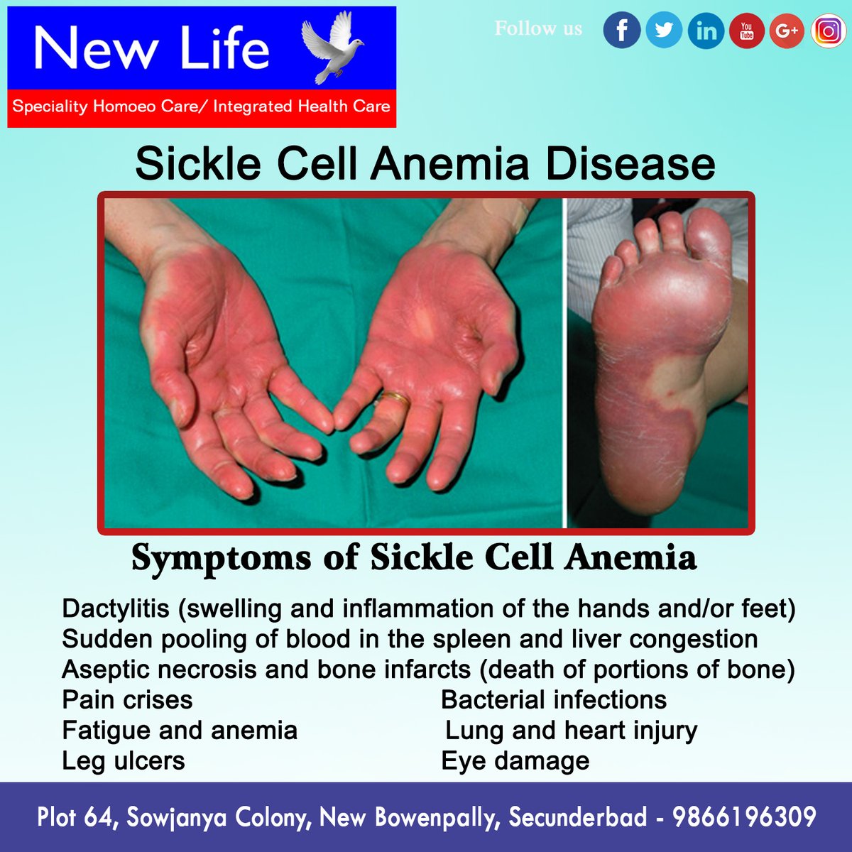 HomeoNew's tweet photo. Many difficult diseases who could not be relieved by experts of leading hospitals have recovered fully at our centre.

Timings : 10 Am to 2 PM and 4 PM to 8 PM(For appointment)
Closed : Wednesday and Sunday Evenings
Mail Id : newlifehomeocare9@gmail.com
Contact : 9866196309 https://t.co/1wnBG2nHuJ