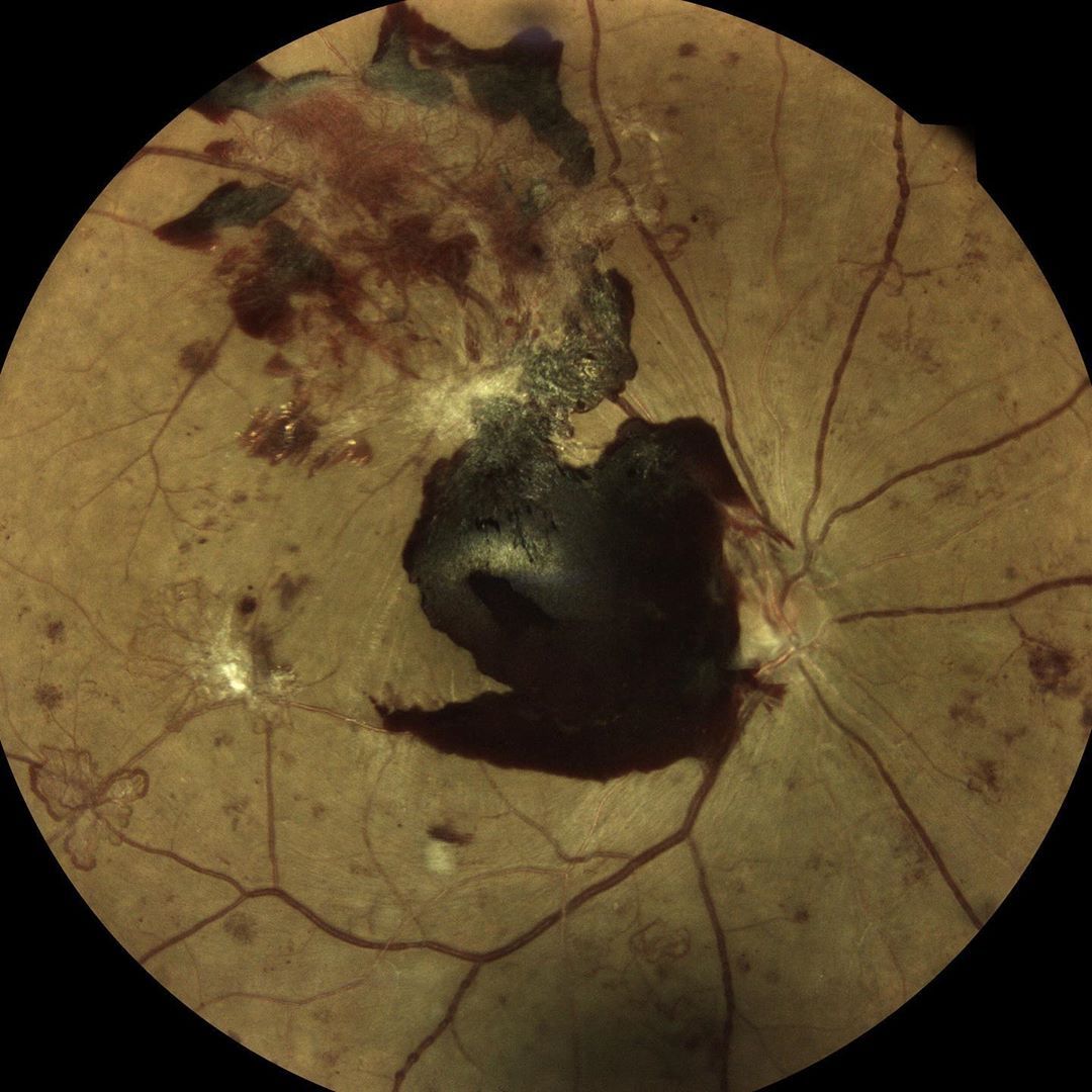 CENTERVUE tweet media