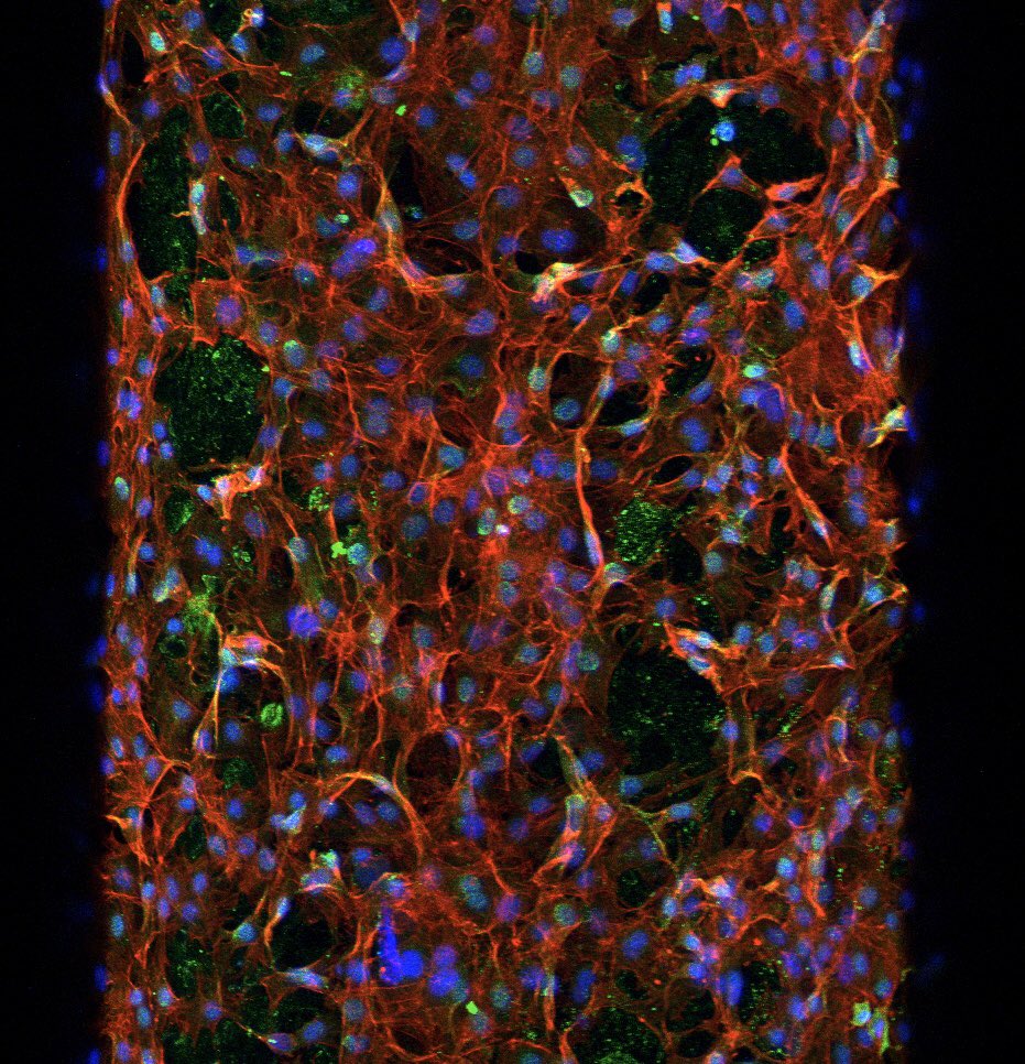 🎄Christmas🎄confocal imaging @qut_ihbi #scaffold