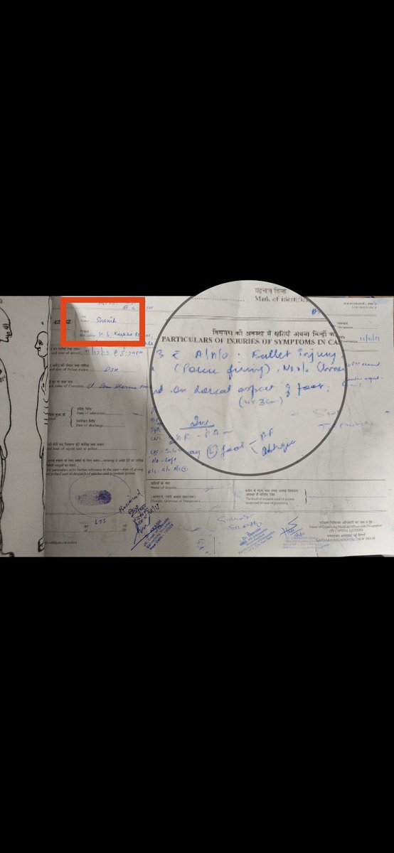 SreenivasanJain's tweet photo. Medico Legal Reports of the two Jamia protestors (Shoaib and Ajaz) admitted to Delhi’s Safdarjung Hospital. 

In both cases, says ‘bullet injury due to police firing.’ @OnReality_Check https://t.co/6IC9dOuDzS