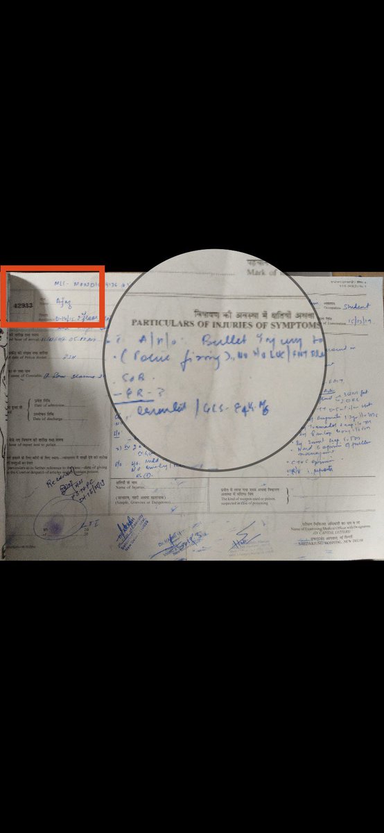 SreenivasanJain's tweet photo. Medico Legal Reports of the two Jamia protestors (Shoaib and Ajaz) admitted to Delhi’s Safdarjung Hospital. 

In both cases, says ‘bullet injury due to police firing.’ @OnReality_Check https://t.co/6IC9dOuDzS