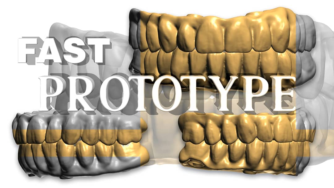 LorantStumpf's tweet photo. #digital, #dentistry, #cad, #cam, #digitaldentistry, #cadcam, #dentistry, #digital, #3shape, #dental, #intraoralscanning, #impressiontaking, #implants, #digitalsolution, #digitalrestoration, #dentallab, #printing, #education, #technology, #cadcamdentistry, #digitalimpression https://t.co/OuoPm6Kcwd